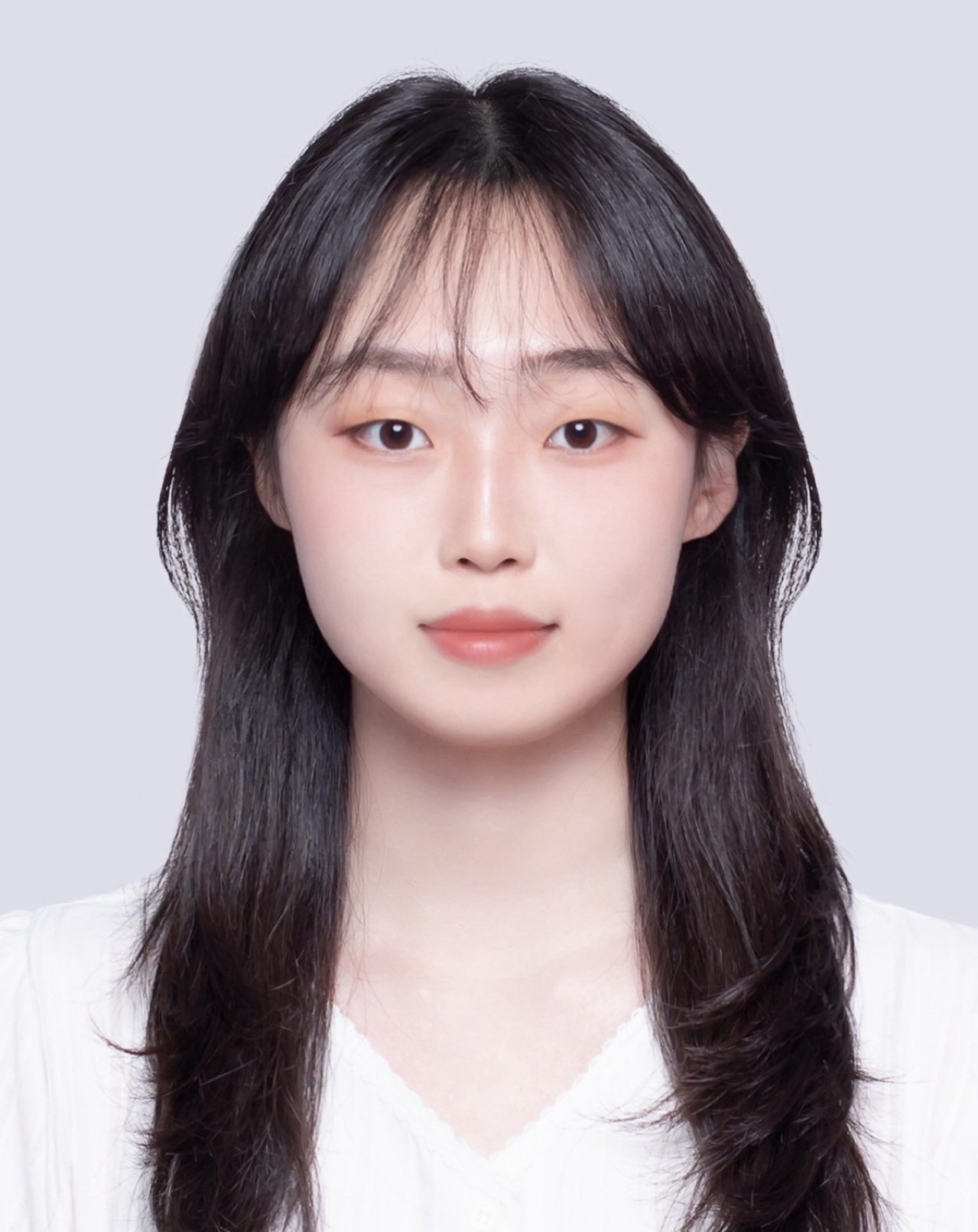 한림대 의과대학 우서영 석사졸업생, 외상성 뇌손상 후 발생하는 신경손상 억제 효과 규명